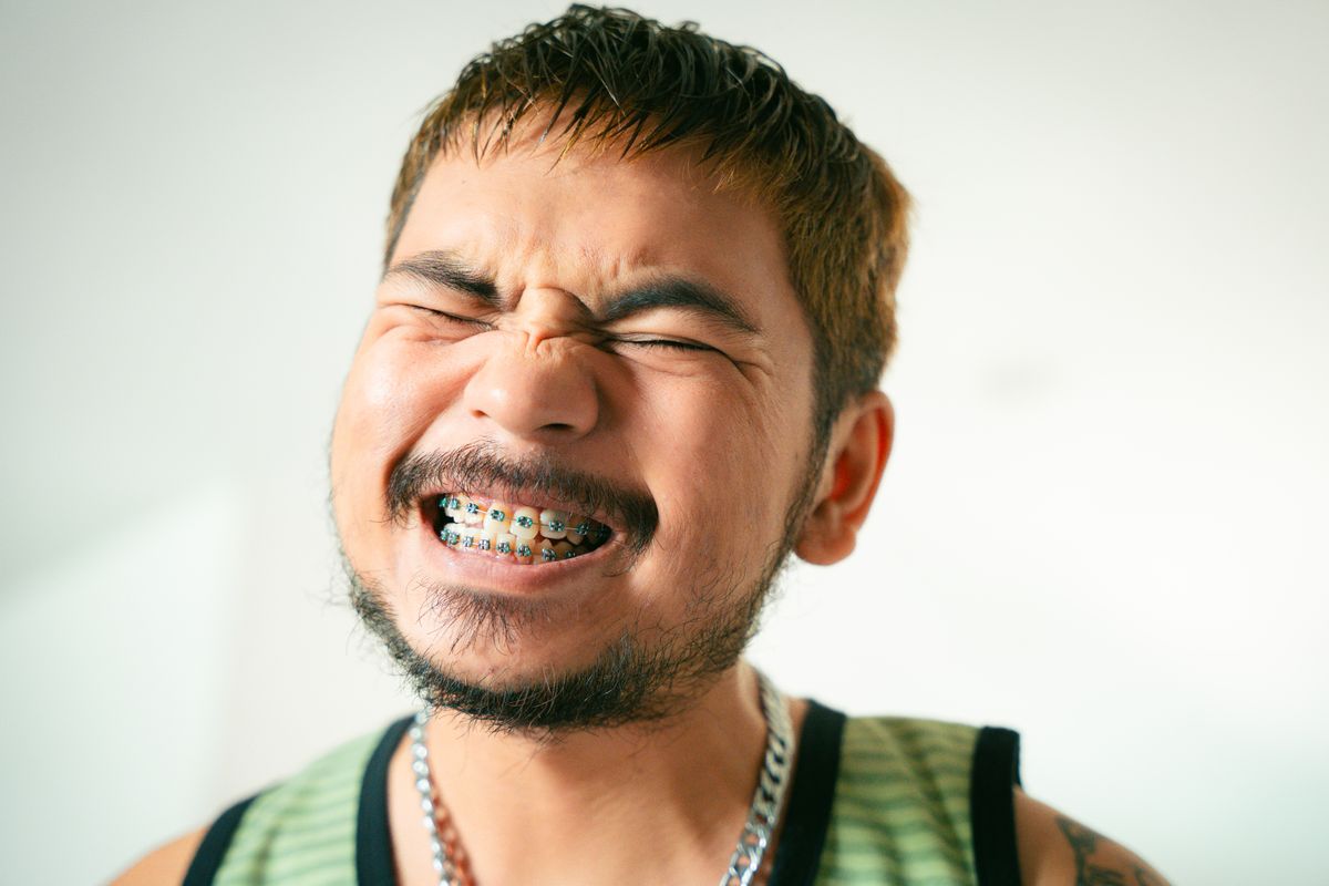 Nahaufnahme einer festsitzenden Zahnspange mit bunten Brackets bei einem jugendlichen Patienten